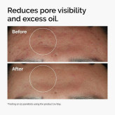 سرم ضد جوش دی اوردینری مدل %Niacinamide 10% + Zinc 1 حجم 30 میلی لیتر