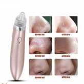 دستگاه پاکسازی پوست- میکرودرم خانگی مدل XN-8030