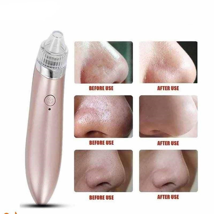 دستگاه پاکسازی پوست- میکرودرم خانگی مدل XN-8030